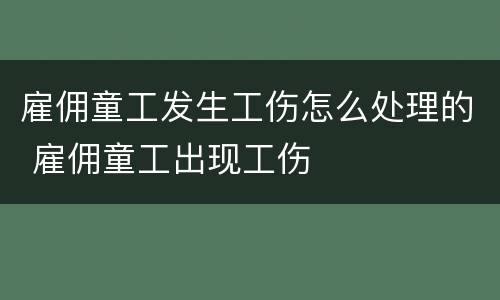 雇佣童工发生工伤怎么处理的 雇佣童工出现工伤
