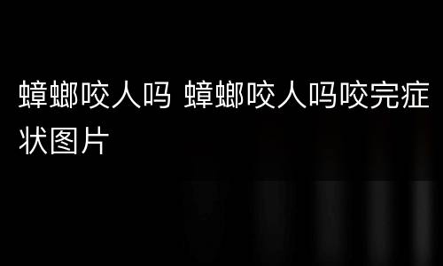 蟑螂咬人吗 蟑螂咬人吗咬完症状图片